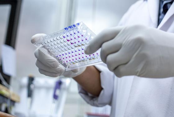 A researcher examines samples in the lab