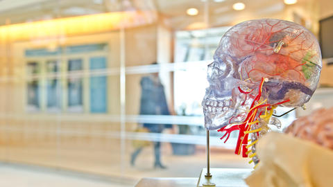 A transparent anatomical model of a human head displaying brain structures, nerves, and blood vessels in red and yellow, mounted on a stand